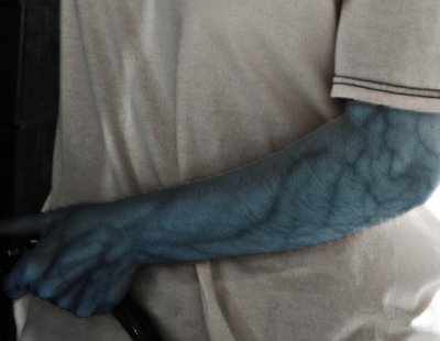 IR_Vein.jpg