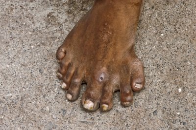 This guy ran out of a shop and asked me to photograph his foot. It looked like this.