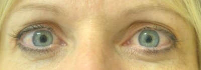 Eyes8137