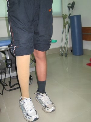 All ready for the stride IMG_1059.JPG