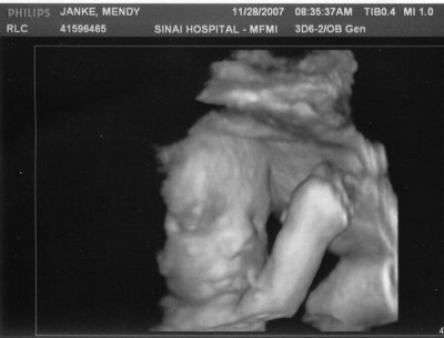Our first look at our new baby boy