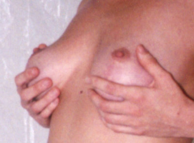 Breast Breast 016