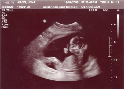ultrasound_5.jpg