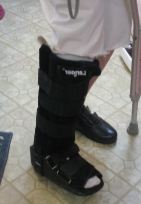 4/10 have to wear that boot for 5 weeks