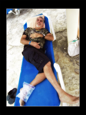 Cuba - Holguin - Luna Mares Hotel - John (ankle sprain)