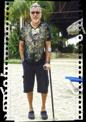 2010 - John (ankle sprain) - Cuba - Holguin - Luna Mares Hotel