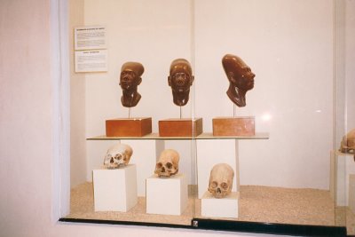 008 - Deformed skulls (pre-Inca)