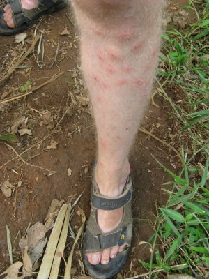My poor leg- some bugs really got me!  But only the left leg, very strange.  Must taste better.