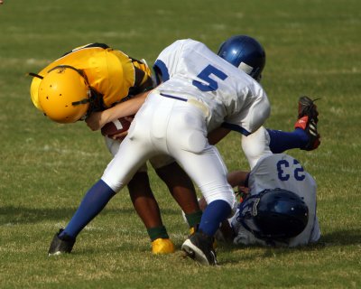 SAS vs SVS (B)
