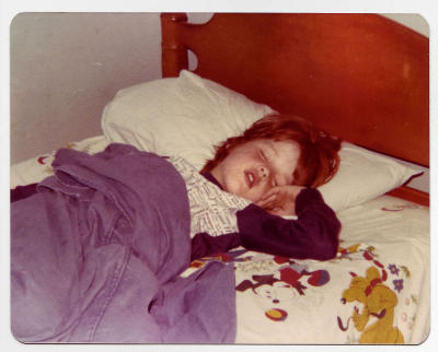 Charlie in sedation, circa 1976