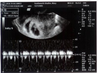 g3/64/545064/3/53923496.BabeBheartbeat.jpg