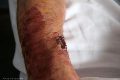 Arm3734.jpg