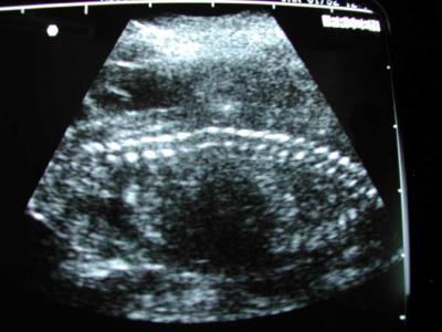 g3/74/303674/3/56274418.DoggySpine.jpg
