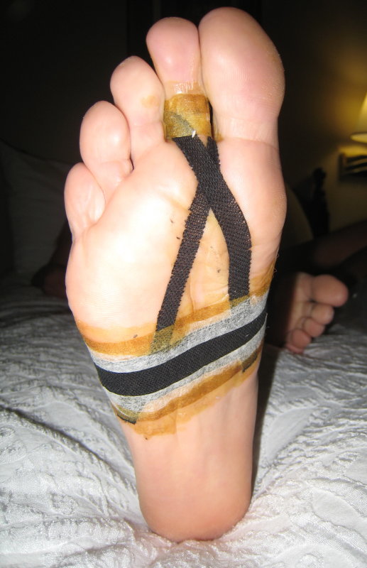 KinesioTape, micropore, tincture of benzoin