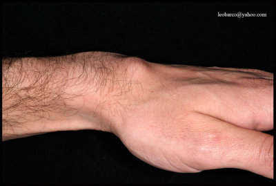 GANGLION_01.jpg