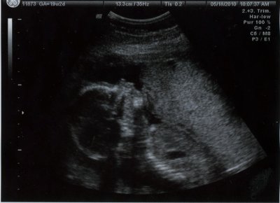 ultrasound004b.jpg