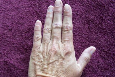 ACA Hand close up thin skin-no 9.jpg