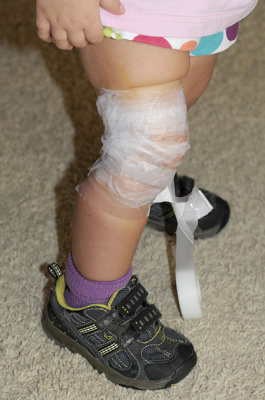 Close-up view of preventative tape job.