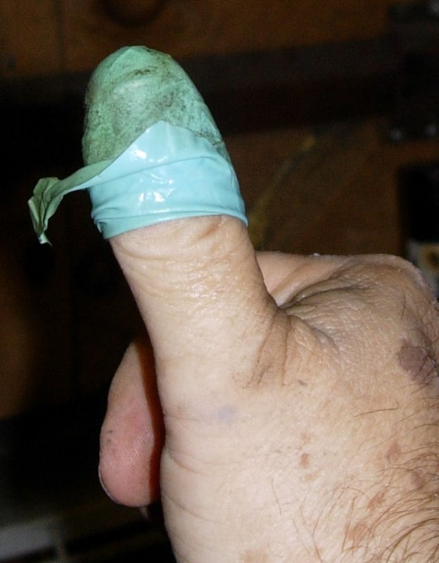Glove failure.jpg