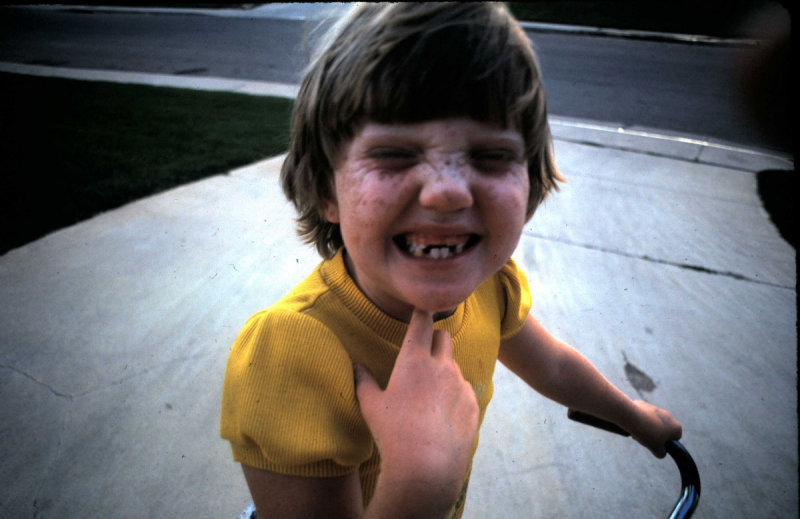 mb70s_teeth.jpg