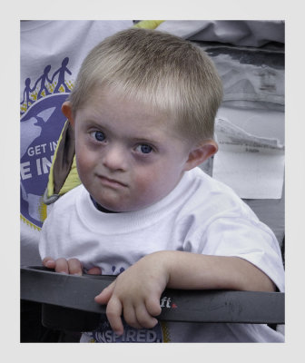 A child with Down's syndrome