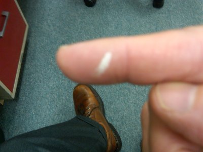 FingerWhiteSpot.jpg
