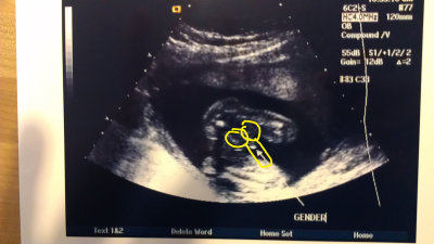 tinyboy.jpg
