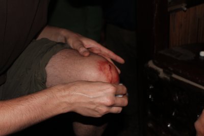 Elephant Safari 40 - Dan's Knee