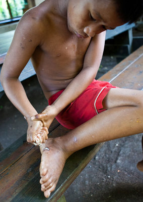 Squeezing coconut meat into a wound. IMG_3352.jpg