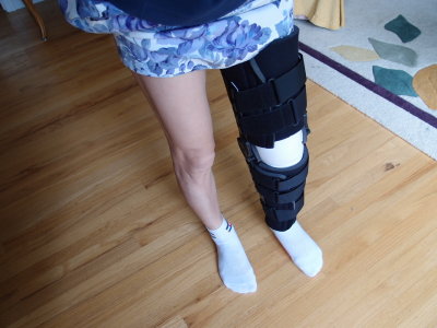 Emiko had to have surgery on her knee.