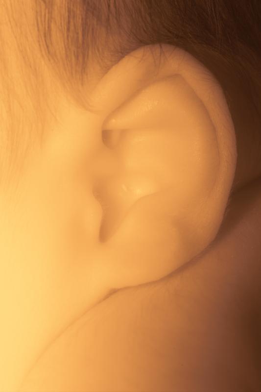 IR Ear