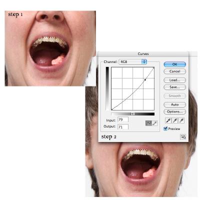 ps-help 4 white teeth.jpg