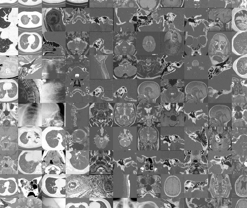 sag_brain_mri.jpg