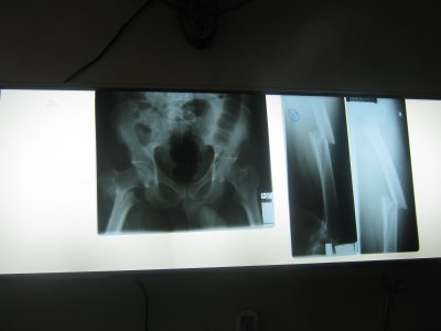 2010 06 20_2618.JPG