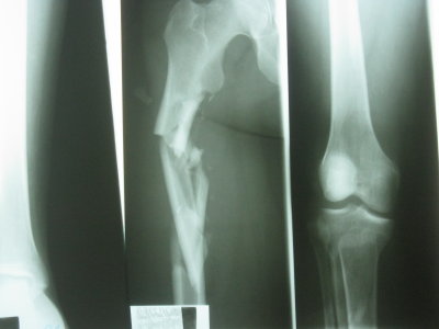 2010 06 20_2620.JPG