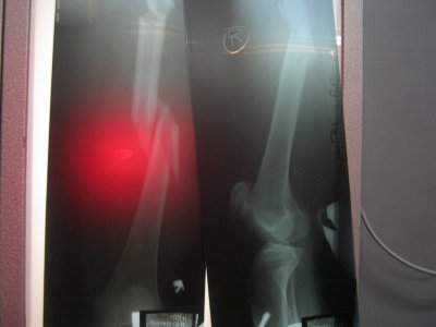 2010 06 20_2631.JPG