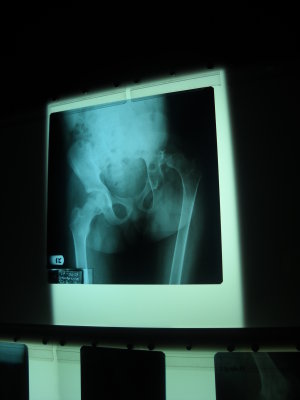 2010 06 23_2571.JPG