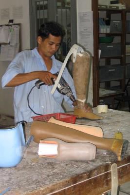 Prosthesis being made