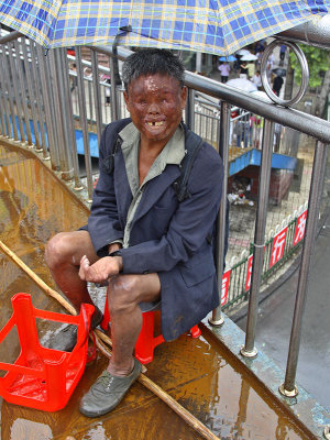 China blind and disfigured