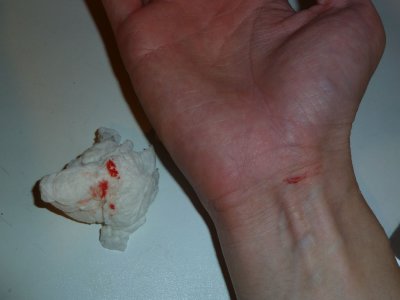 which tried to kill me... (ok my chopping board slipped and my knife did some funky gymnastics =P)