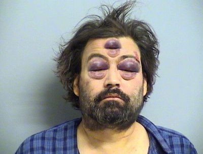 blackeyes.jpg