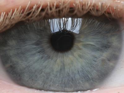 my eye