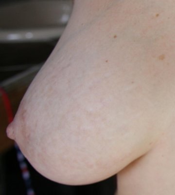 Breast M 051.jpg
