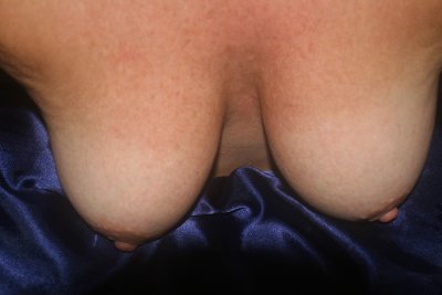 Breast Breast 041