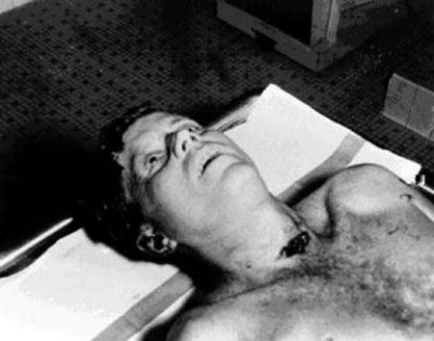 El cadáver del Presidente Kennedy