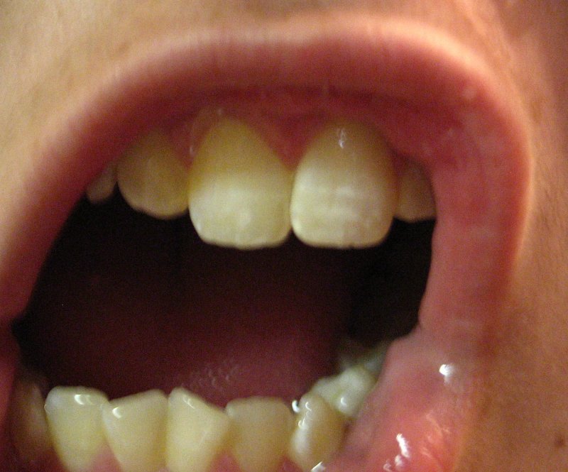 urrrrrrrrrrrrrrrrrr 2