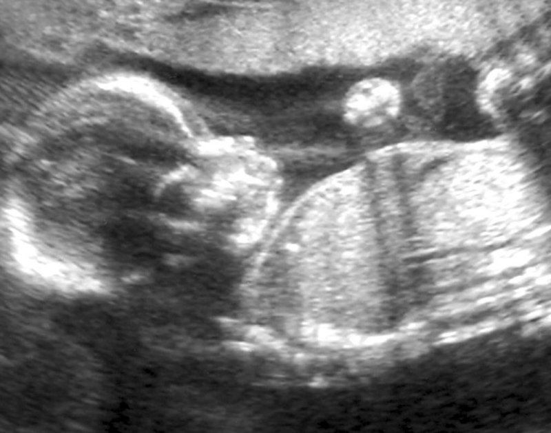 pb07-03-09-09.jpg