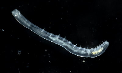 Oligochaete worm (Chaetogaster sp.)