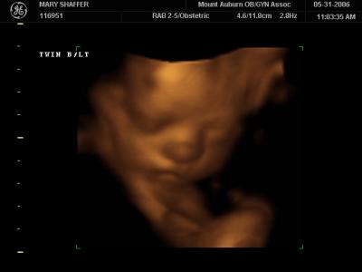 ultrasound_pictures
