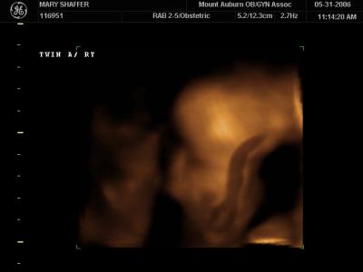 ultrasound_pictures